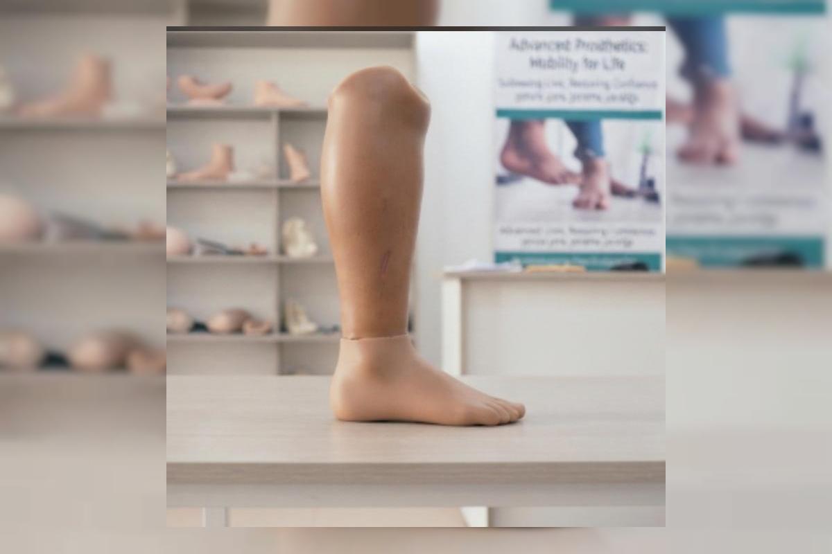 Silicone Prosthetic Covers in Nigeria: Cosmetic Restoration and the Psychology of Limb Loss